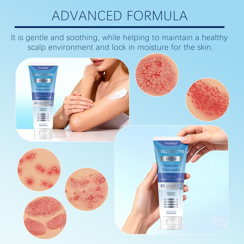 Truerelief Folliculitis Soothing Treatment Cream, Effective Treatment for Folliculitis Scalp Face and Body 120G Haircare Organic Soothing Cream